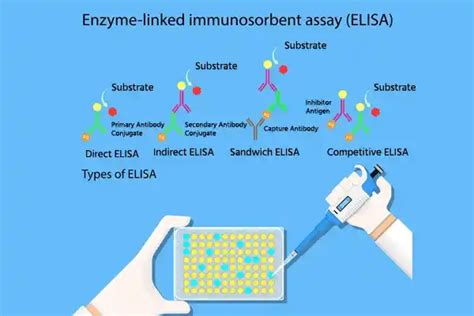 elisa test quest diagnostics|elisa test simple explanation.